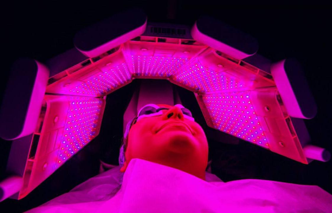 Фотодинамическая терапия (ФДТ)